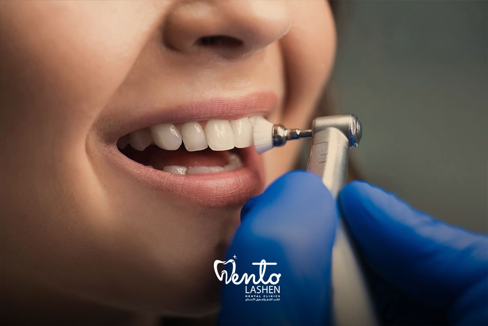 تركيب الكروان image