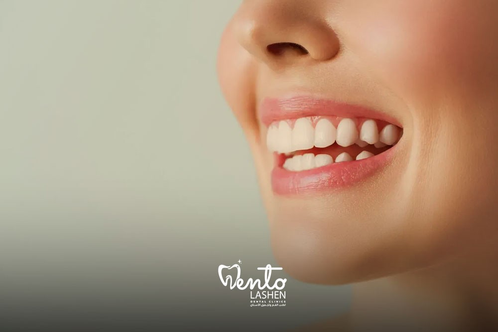 تركيب الكروان image