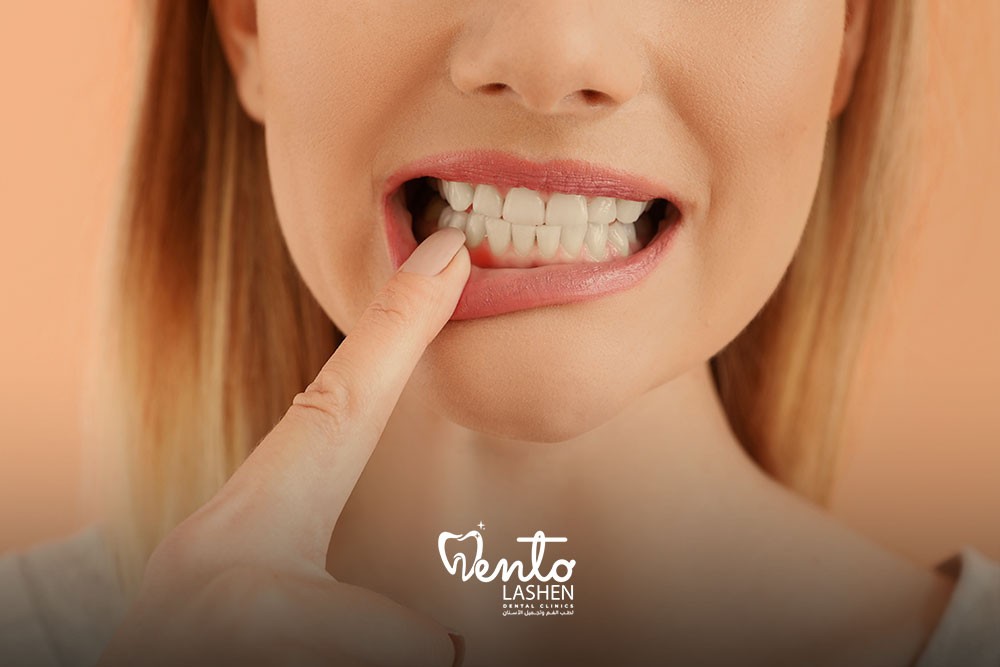 Periodontal treatment image