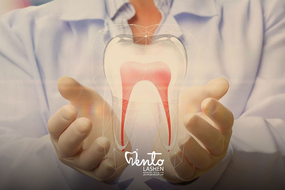 Root canal treatment image